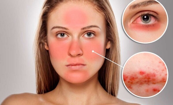 tac-hai-nguy-hiem-của-my-pham-gia