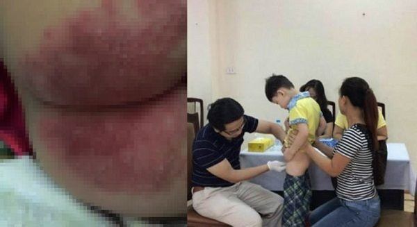 Hậu quả khi sử dụng bỉm giả